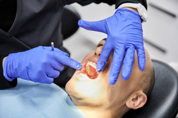 Best Emergency Broken Tooth Repair in Pinehurst, NC